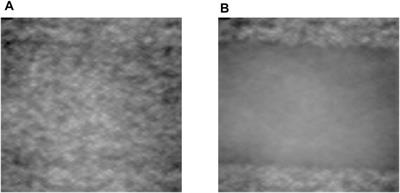 Pulsatile Flow Measurement by a Speckle Triangle Assessment